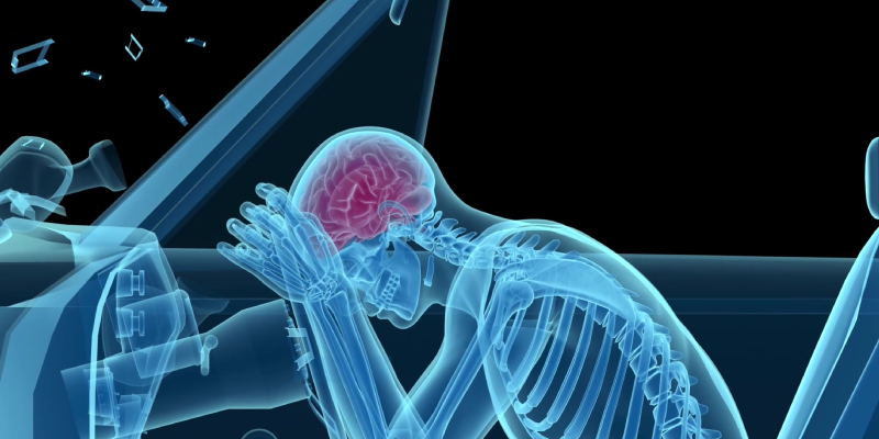 TBI- Traumatic Brain Injury After A Car Accident - Attorneys Blog